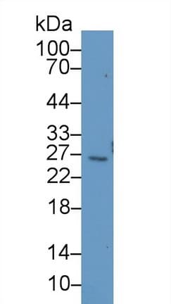 BCL2L1 / BCL-XL Antibody (aa2-212, Biotin)