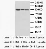 CTNNB1 / Beta Catenin Antibody (C-Terminus, Sepharose)
