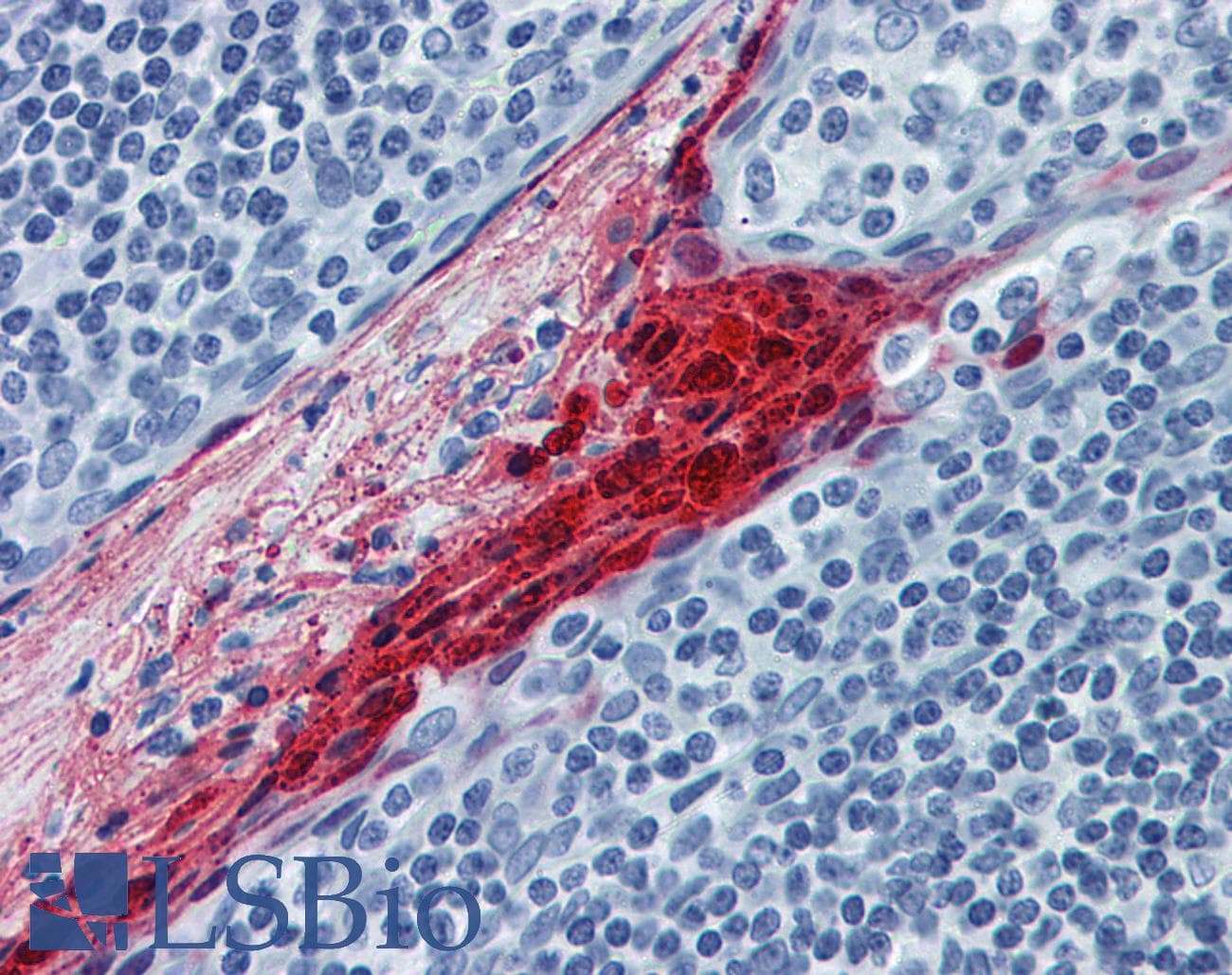 IHC-plus™ SPRR3 Antibody (clone 4A12)
