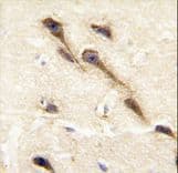 CYP26B1 Antibody (aa398-430)
