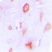 CYP4X1 Antibody (Internal)