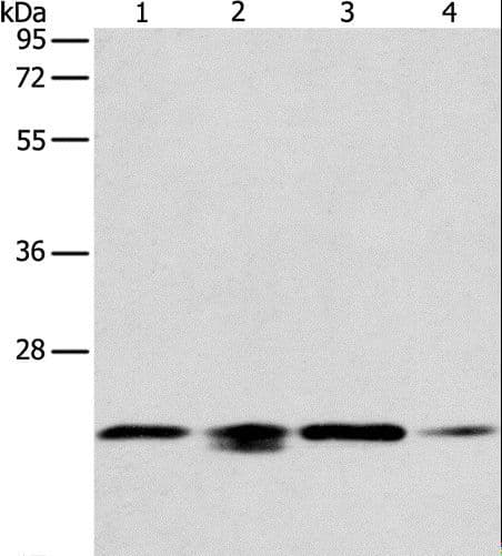 PRDX2 / Peroxiredoxin 2 Antibody