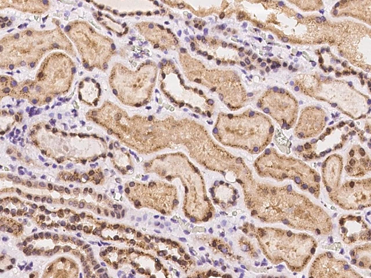 CLASP1 Antibody