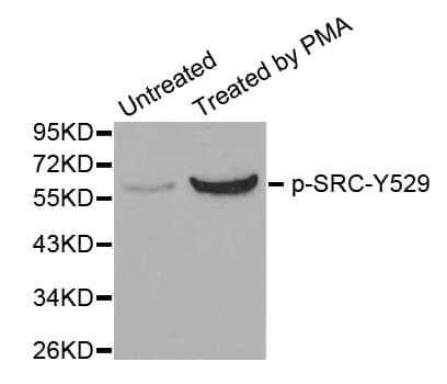 SRC Antibody (phospho-Tyr529)