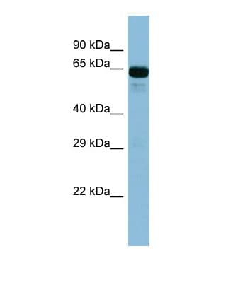 Polyclonal Rabbit anti-Human ACSL6 Antibody (aa193-242, WB)