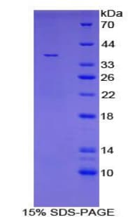 Mouse TBP / GTF2D Protein (Recombinant 6His, N-terminus)