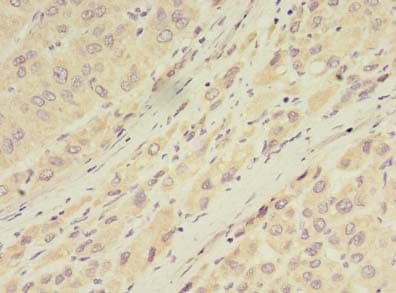 GDPD2 / GDE3 Antibody