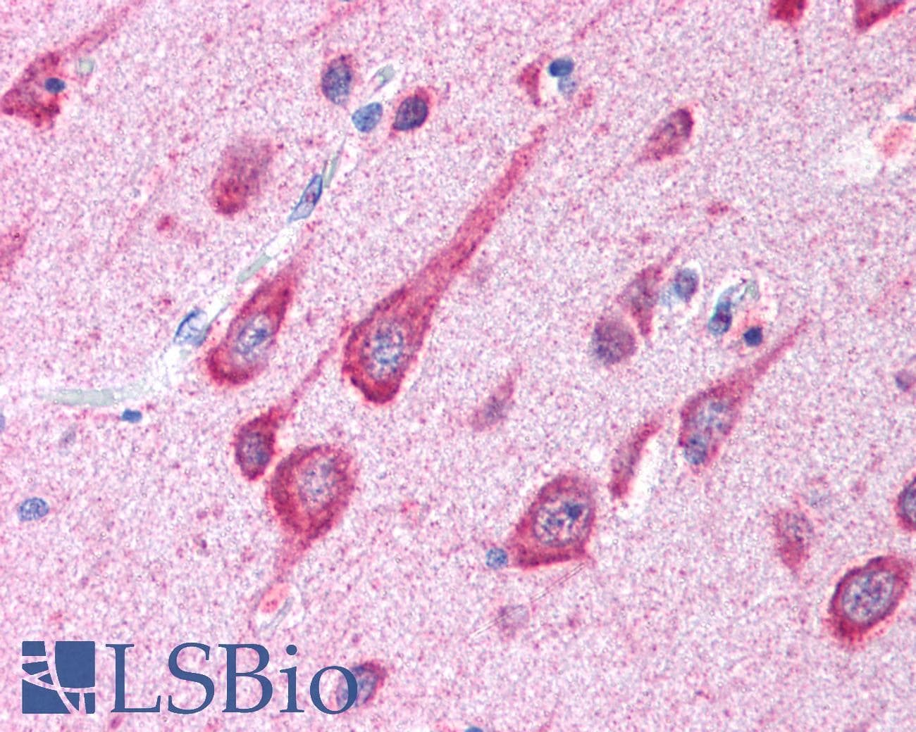 Polyclonal Rabbit anti-Human MAP1LC3B / LC3B Antibody (Biotin, aa1-100, IHC, WB)