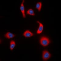 NFKBIE / IKB Epsilon Antibody (phospho-Ser22)