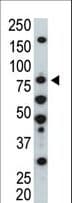 Polyclonal Rabbit anti-Human HUNK / B19 Antibody (aa659-690, IHC, WB)