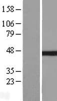 NFKBIB / IKB Beta / IKBB Protein (Over-Expression Lysate Myc-DDK (Flag))