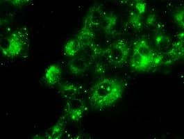 PRL / Prolactin Antibody (clone OTI11B11)