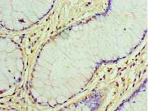 GCKR Antibody (aa1-625, Biotin)