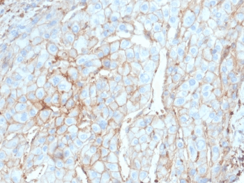 Monoclonal Mouse anti-Human CD274 / B7-H1 / PD-L1 Antibody (clone PDL1/2746, IHC, IF, WB)
