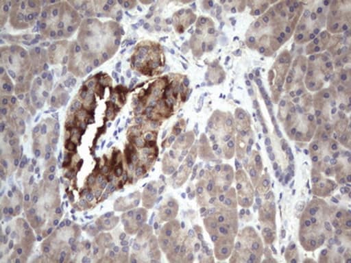 BFSP1 / Filensin Antibody (aa405-665, clone OTI3C11, Carrier-free)