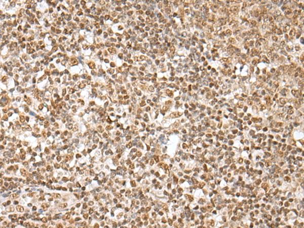 ZNF354A Antibody