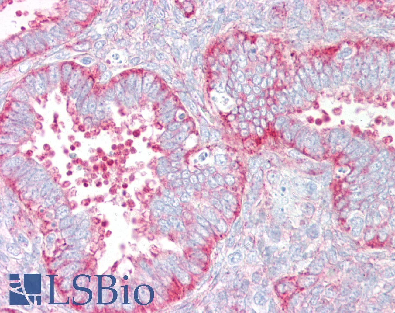 IHC-plus™ VAMP3 / VAMP-3 Antibody (aa1-50)
