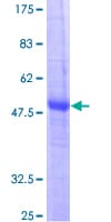 Human CIDEB Protein (Recombinant GST)