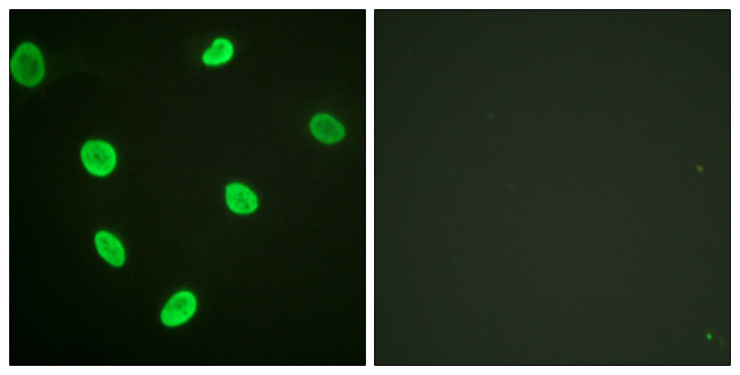 Histone H2B Antibody (Acetyl-Lys12)