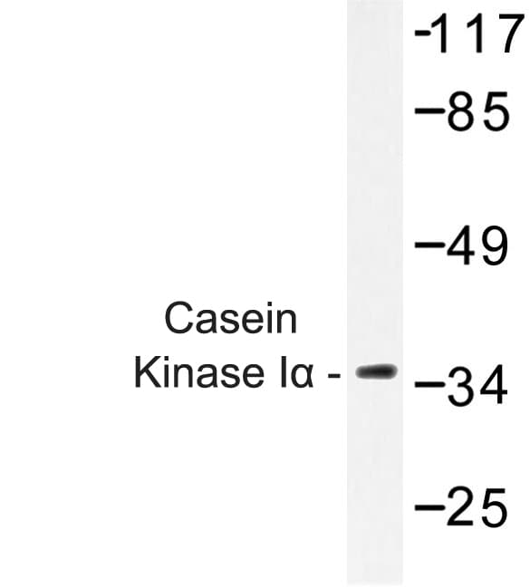 CSNK1A1 / CK1 Alpha Antibody (Phe158)