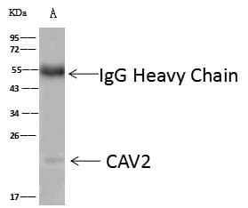 Polyclonal Rabbit anti-Mouse CAV2 / Caveolin 2 Antibody (Preservative Free, WB)
