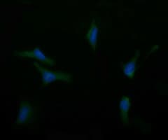 ASGR2 Antibody (clone OTI4B6)