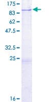Human DARS2 Protein (Recombinant GST)
