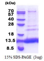 Human MTCP1NB Protein (Recombinant His)