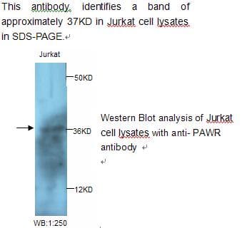Polyclonal Rabbit anti-Human PAWR / PAR4 Antibody (WB)