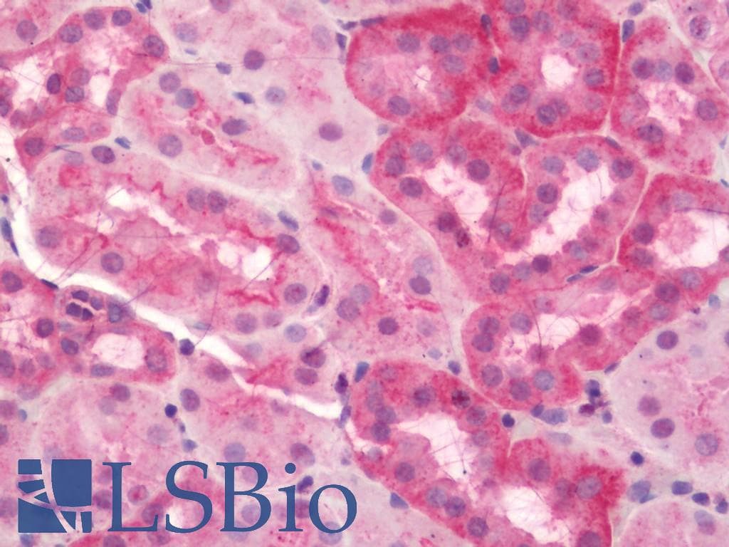 IHC-plus™ SLC9A1 / NHE1 Antibody