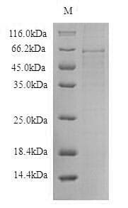 Human AGT / Angiotensinogen Protein (Recombinant 6His-SUMO, N-terminus)