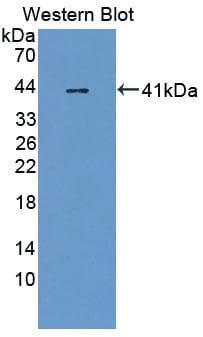 CGB / hCG Beta Antibody