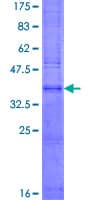 Human TMEM159 Protein (Recombinant GST)