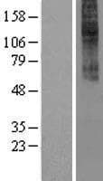 Human CCKAR / CCK1R Protein (Over-Expression Lysate Myc-DDK (Flag))
