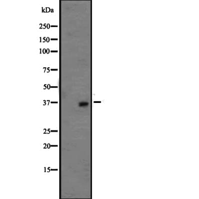 Polyclonal Rabbit anti-Human OR1L3 Antibody (IHC, WB)