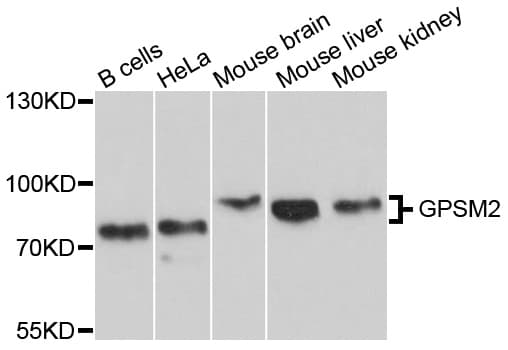 GPSM2 / LGN Antibody