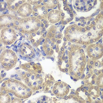 H6PD / G6PDH Antibody