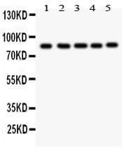 Polyclonal Rabbit anti-Human FOXM1 Antibody (aa411-763, WB)