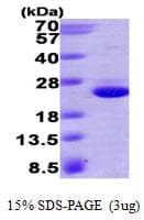 Human HRAS / H-Ras Protein (Recombinant His)