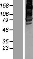 Human AFAP1L2 / XB130 Protein (Over-Expression Lysate Myc-DDK (Flag))