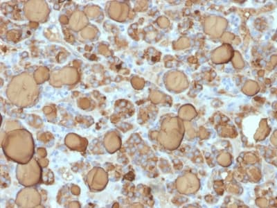 Recombinant Monoclonal Rabbit anti-Human TG / Thyroglobulin Antibody (clone TGB/1968R, Azide-free,Carrier-free, IHC)