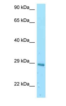 EIF3K Antibody (aa68-117)