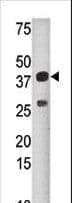 SULT1C2 / Sulfotransferase 1C2 Antibody (aa1-30)