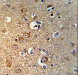 Gephyrin Antibody (aa437-466)