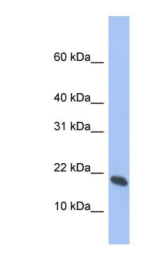 Polyclonal Rabbit anti-Human GMFG Antibody (aa35-84, WB)