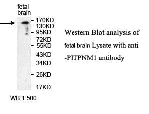 PITPNM1 / NIR2 Antibody (aa213-468)