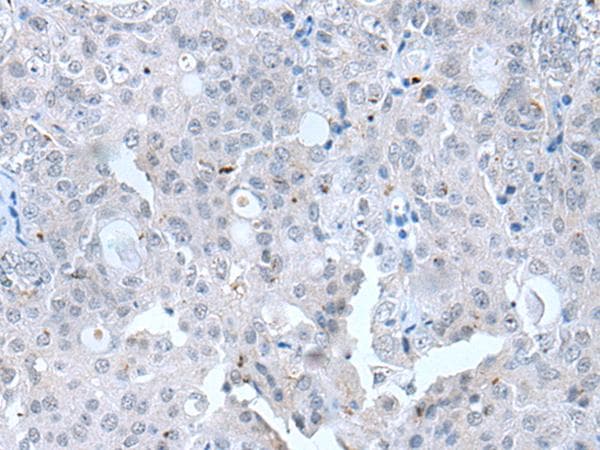Polyclonal Rabbit anti-Human CLDN12 / Claudin 12 Antibody (IHC)