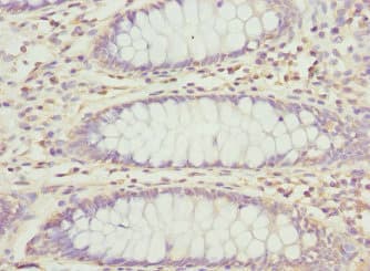 PECR Antibody
