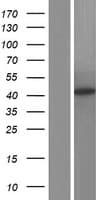 Human ACAT1 Protein (Over-Expression Lysate Myc-DDK (Flag))