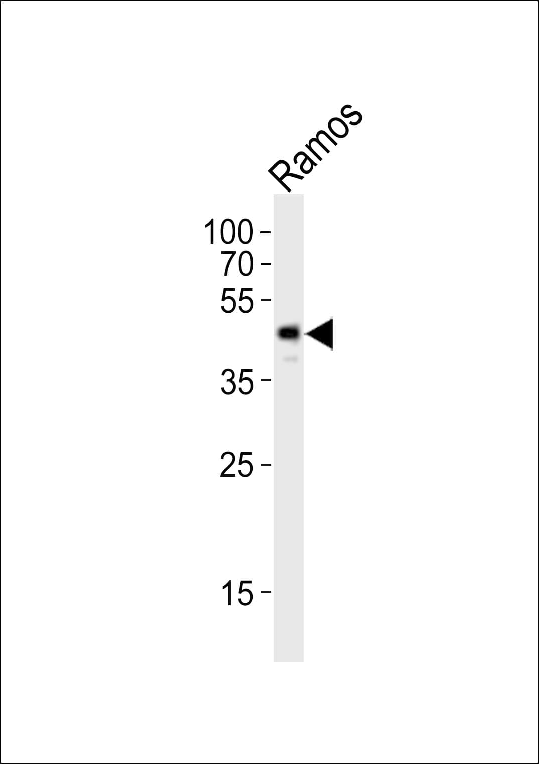 c-Src Kinase / CSK Antibody (aa164-197)